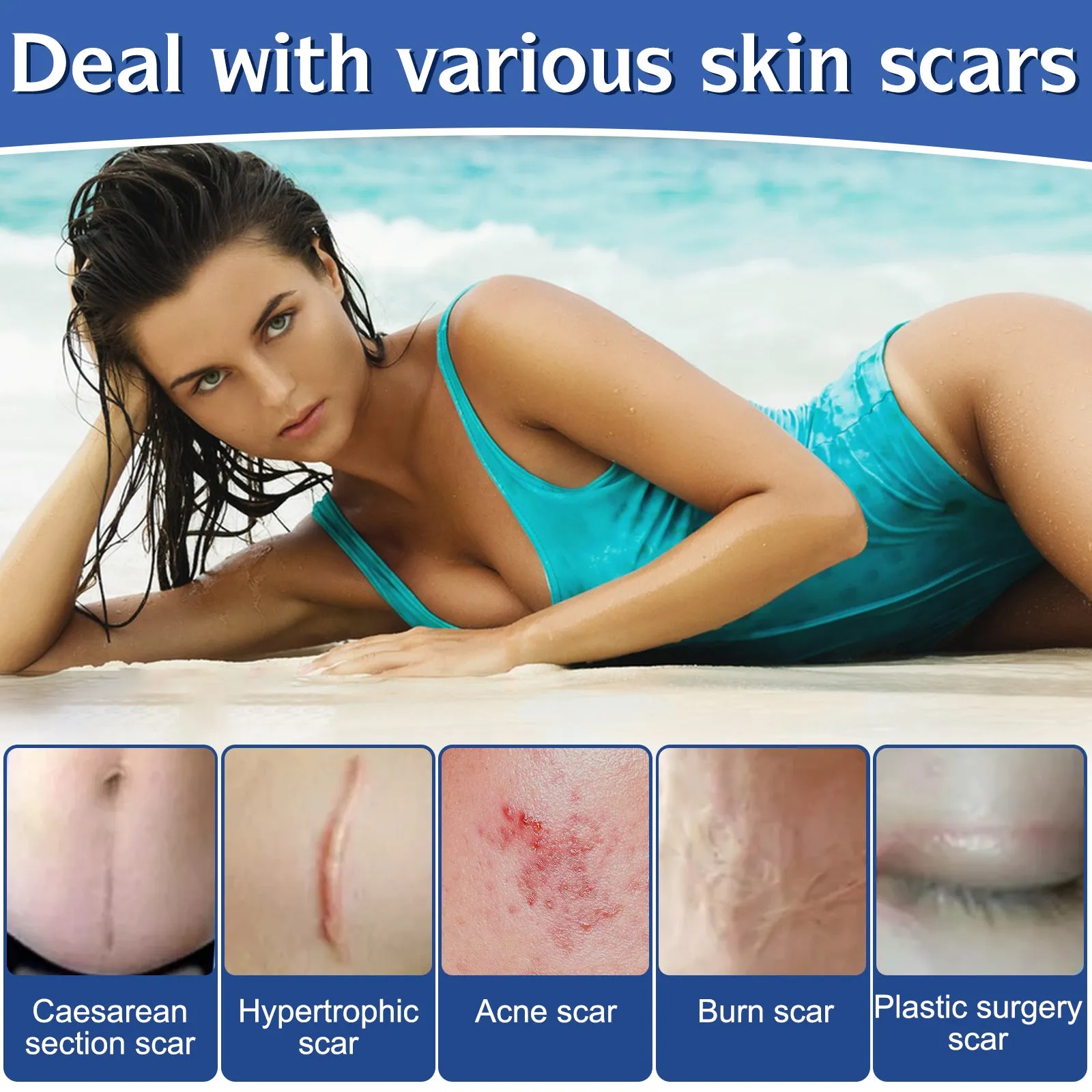 ALIVER Silicone Scar Sheets, Silicone Scar Tape-1.6”x120”, Scar Removal Strips for Acne Scars C-Section & Keloid Surgery Scars Sheets - 6-8 Month Supply